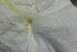 孕期白带不好（孕期白带黄绿色是怎么回事）