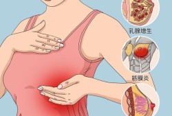 怀孕25周了乳房有点疼是怎么回事,易孕期乳房痛正常的吗