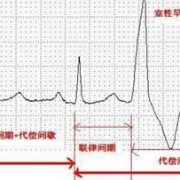 孕妇心脏早搏对胎儿有影响吗,胎儿早搏是什么意思啊