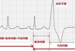 孕妇心脏早搏对胎儿有影响吗,胎儿早搏是什么意思啊