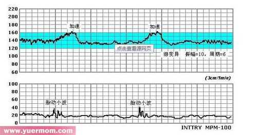胎儿心跳(胎儿心率快怎么回事) 第1张 胎儿心跳(胎儿心率快怎么回事) 第1张