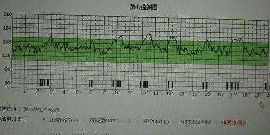 胎儿心跳(胎儿心率快怎么回事) 第3张 胎儿心跳(胎儿心率快怎么回事) 第3张