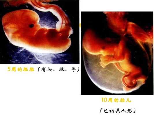 胎儿发育(胎儿几个月发育眼睛?可以看多远的呢) 第1张 胎儿发育(胎儿几个月发育眼睛?可以看多远的呢) 第1张