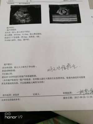 fl是什么中文缩写,fl是胎儿的什么指标 第2张 fl是什么中文缩写,fl是胎儿的什么指标 第2张