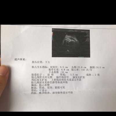 fl是什么中文缩写,fl是胎儿的什么指标 第1张 fl是什么中文缩写,fl是胎儿的什么指标 第1张