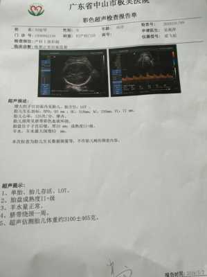 fl是什么中文缩写,fl是胎儿的什么指标 第3张 fl是什么中文缩写,fl是胎儿的什么指标 第3张
