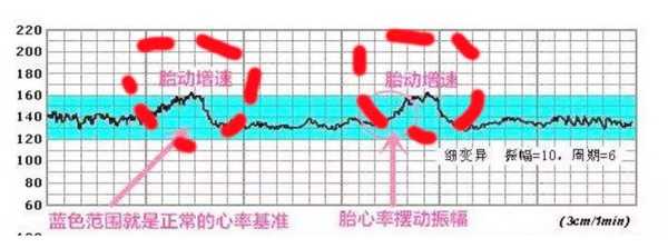 胎儿发育全过程(怀孕几周有胎心,有了胎心就表示胎儿发育很好了吗) 第2张 胎儿发育全过程(怀孕几周有胎心,有了胎心就表示胎儿发育很好了吗) 第2张