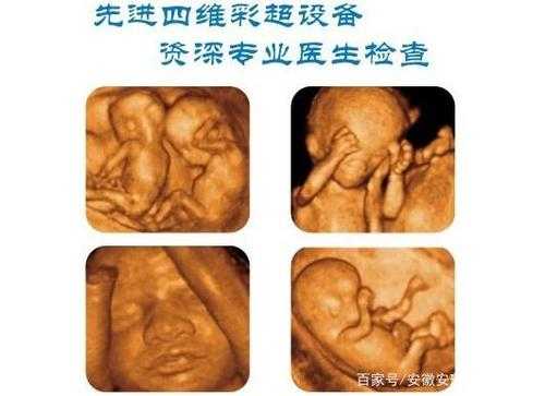 孕期四维检查（做四维检查主要是查哪些）  第3张
