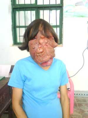 胎儿畸形是什么意思?什么原因导致的,胎儿先天畸形在围产儿死亡中占第一位的是 第1张 胎儿畸形是什么意思?什么原因导致的,胎儿先天畸形在围产儿死亡中占第一位的是 第1张