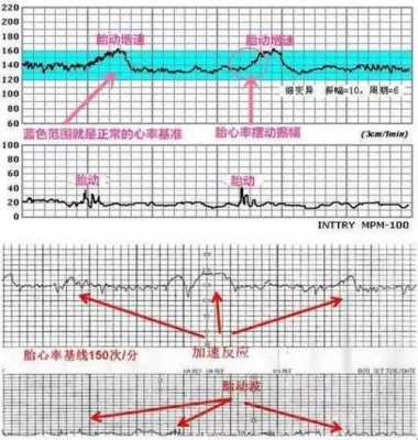 胎儿胎心率（胎儿胎心率正常值）  第1张