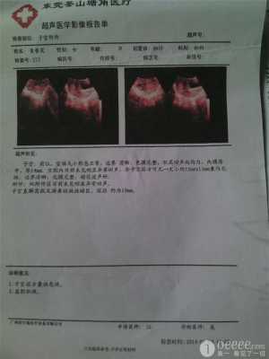 胎儿b超(孕14周b超准确率多高) 第3张 胎儿b超(孕14周b超准确率多高) 第3张