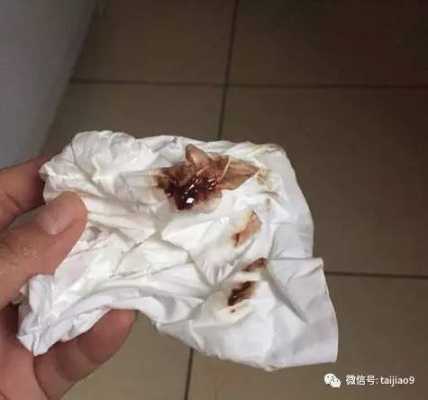 有褐色分泌物都会胎停的吗,这样是不是很危险的呢, 第1张 有褐色分泌物都会胎停的吗,这样是不是很危险的呢, 第1张