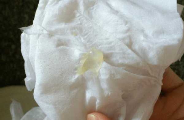 孕妇白带发绿对胎儿有影响吗（怀孕后一坨坨黄绿色分泌物）  第3张