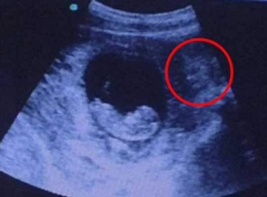 五个月的胎儿有多大（怀孕五个月了宝宝会缺氧吗）  第3张