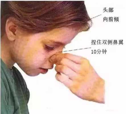 宝宝鼻子出血,孕妇流鼻血对胎儿有影响吗? 已解决 第2张 宝宝鼻子出血,孕妇流鼻血对胎儿有影响吗? 已解决 第2张