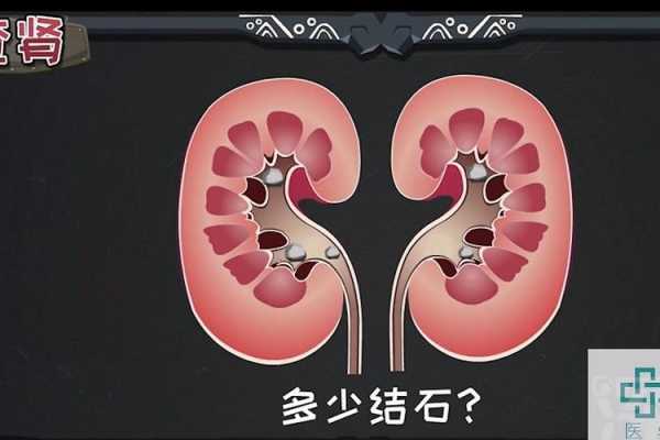 我老婆怀孕6个月查出左肾积水是怎么回事,胎儿肾积水是什么原因引起的 第1张 我老婆怀孕6个月查出左肾积水是怎么回事,胎儿肾积水是什么原因引起的 第1张