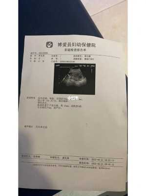 胎儿偏小一周怎么补(胎儿偏小一周怎么补上去) 第2张 胎儿偏小一周怎么补(胎儿偏小一周怎么补上去) 第2张