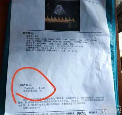 胎儿偏小一周怎么补(胎儿偏小一周怎么补上去) 第3张 胎儿偏小一周怎么补(胎儿偏小一周怎么补上去) 第3张