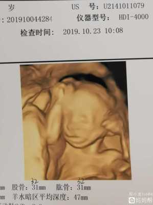 20周的胎儿有多大(怀孕20周的胎儿有多大,估算有2斤会太小了吗) 第2张 20周的胎儿有多大(怀孕20周的胎儿有多大,估算有2斤会太小了吗) 第2张