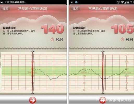 胎儿心率(胎儿心率正常范围是多少) 第2张 胎儿心率(胎儿心率正常范围是多少) 第2张