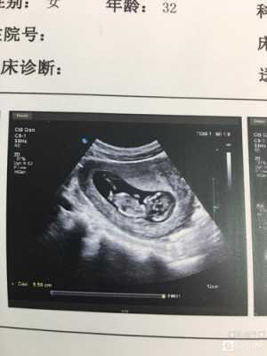孕11周胎儿稳定了吗(我怀孕11周了,没有任何反应,这是怎么回事呢) 第2张 孕11周胎儿稳定了吗(我怀孕11周了,没有任何反应,这是怎么回事呢) 第2张