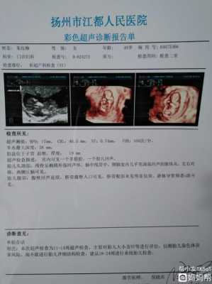 孕11周胎儿稳定了吗（我怀孕11周了，没有任何反应，这是怎么回事呢）  第1张