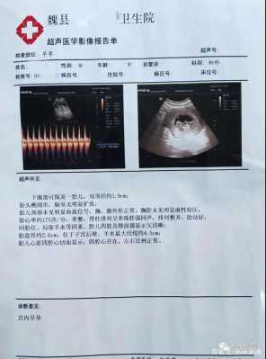 B超检查的怀孕周数是否准确,胎儿期是指几到几周  第1张