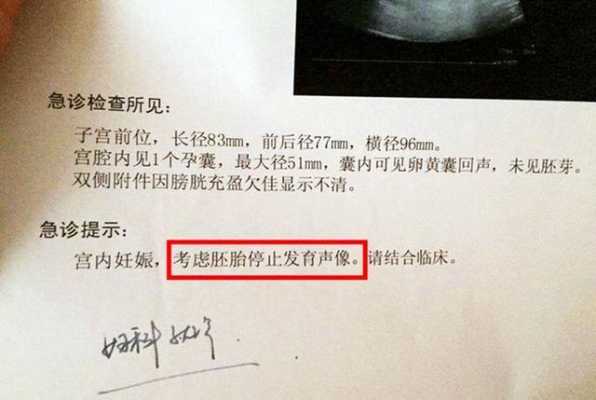 胎儿没你想的那么脆弱(胎停前其实有暗示信号) 第1张 胎儿没你想的那么脆弱(胎停前其实有暗示信号) 第1张