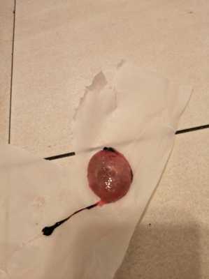 胎儿停止发育是什么原因造成的(怀孕10周胎儿停止发育应该怎么办) 第2张 胎儿停止发育是什么原因造成的(怀孕10周胎儿停止发育应该怎么办) 第2张