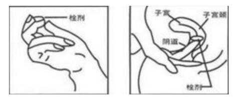 霉菌性阴道炎怀孕了怎么办,霉菌自愈的最佳方法 第2张 霉菌性阴道炎怀孕了怎么办,霉菌自愈的最佳方法 第2张