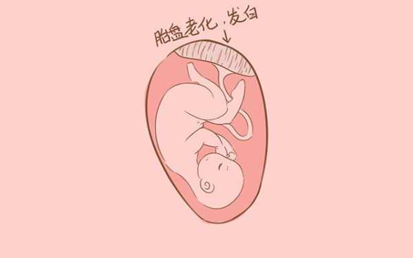 胎盘老化对胎儿有什么影响(孕晚期胎盘老化对胎儿有什么影响) 第2张 胎盘老化对胎儿有什么影响(孕晚期胎盘老化对胎儿有什么影响) 第2张