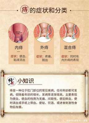 孕期 痔疮(孕期长痔疮怎么治疗) 第2张 孕期 痔疮(孕期长痔疮怎么治疗) 第2张