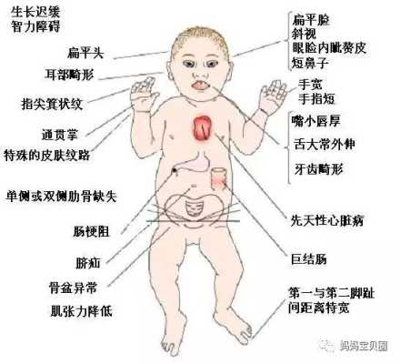 唐氏胎儿在母体的征兆(唐氏胎儿在母体的征兆儿有什么症状) 第1张 唐氏胎儿在母体的征兆(唐氏胎儿在母体的征兆儿有什么症状) 第1张