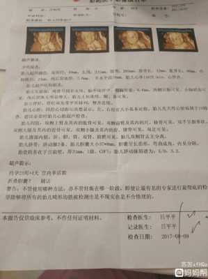 胎儿胆囊偏大有什么影响(四维彩超胎儿胆囊偏大有什么影响) 第1张 胎儿胆囊偏大有什么影响(四维彩超胎儿胆囊偏大有什么影响) 第1张