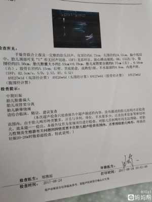 胎儿胆囊偏大有什么影响(四维彩超胎儿胆囊偏大有什么影响) 第2张 胎儿胆囊偏大有什么影响(四维彩超胎儿胆囊偏大有什么影响) 第2张
