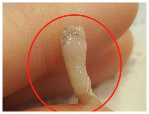 怀孕14周胎儿稳定了吗(试管怀孕14周胎儿稳定了吗) 第1张 怀孕14周胎儿稳定了吗(试管怀孕14周胎儿稳定了吗) 第1张