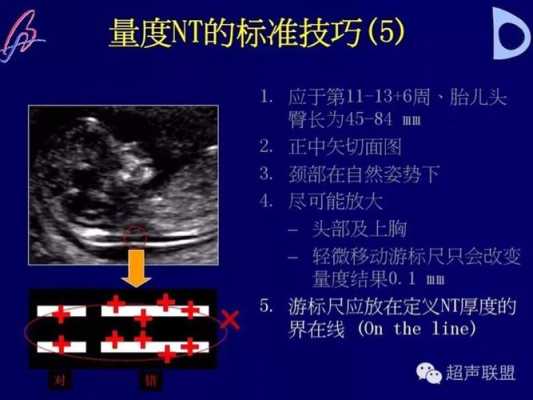 胎儿颈项透明层厚度正常值(胎儿颈项透明层厚度1.3是男孩女孩) 第1张 胎儿颈项透明层厚度正常值(胎儿颈项透明层厚度1.3是男孩女孩) 第1张