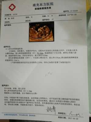 胎儿颈项透明层厚度正常值(胎儿颈项透明层厚度1.3是男孩女孩) 第3张 胎儿颈项透明层厚度正常值(胎儿颈项透明层厚度1.3是男孩女孩) 第3张