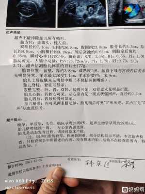 胎儿左心室强光点是什么,四维彩超胎儿心脏有强光点是什么意思 第1张 胎儿左心室强光点是什么,四维彩超胎儿心脏有强光点是什么意思 第1张