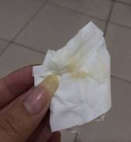 怀孕出现褐色分泌物怎么回事,孕期褐色分泌物是什么原因引起的 第1张 怀孕出现褐色分泌物怎么回事,孕期褐色分泌物是什么原因引起的 第1张
