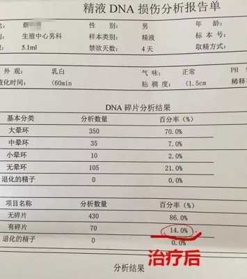 胎儿停育（胚胎停育是什么意思？什么原因会导致胚胎停）  第3张