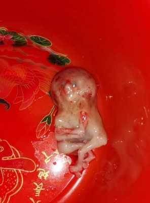 胎儿停育（胚胎停育是什么意思？什么原因会导致胚胎停）  第2张