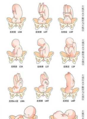 39周胎位头位(左枕横位)不晓得是什么意思,头位左枕横位胎儿图  第1张