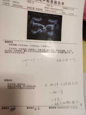 怀孕初期先兆流产孩子能保住吗,先兆流产能保住的几率有多大 第2张 怀孕初期先兆流产孩子能保住吗,先兆流产能保住的几率有多大 第2张