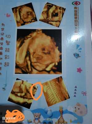 四维彩超怎么看胎儿是男是女呢(四维彩超怎么看胎儿是男是女呢数据) 第2张 四维彩超怎么看胎儿是男是女呢(四维彩超怎么看胎儿是男是女呢数据) 第2张