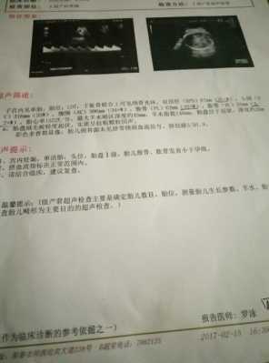 孕23周胎儿发育标准(23周股骨长40mm正常吗?才做的彩超检查,上次检查胎儿还偏小了) 第1张 孕23周胎儿发育标准(23周股骨长40mm正常吗?才做的彩超检查,上次检查胎儿还偏小了) 第1张