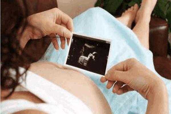 宝宝练习趴着抬头翻过来怎么翻,四维胎儿趴着怎么尽快转身 第3张 宝宝练习趴着抬头翻过来怎么翻,四维胎儿趴着怎么尽快转身 第3张