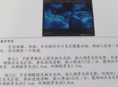 胎儿体重怎么计算最准?孕晚期时候了,怎样估算准一些呢,b超怎么算胎儿体重的公式 第3张 胎儿体重怎么计算最准?孕晚期时候了,怎样估算准一些呢,b超怎么算胎儿体重的公式 第3张