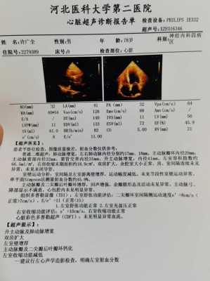 孕期心脏彩超什么时候做(孕期心脏彩超什么时候做最好) 第2张 孕期心脏彩超什么时候做(孕期心脏彩超什么时候做最好) 第2张