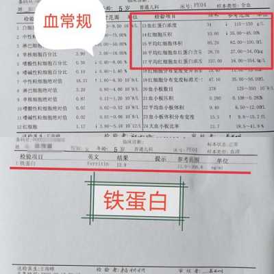 血常规贫血看哪个指标,血常规最怕三种指标低 第1张 血常规贫血看哪个指标,血常规最怕三种指标低 第1张